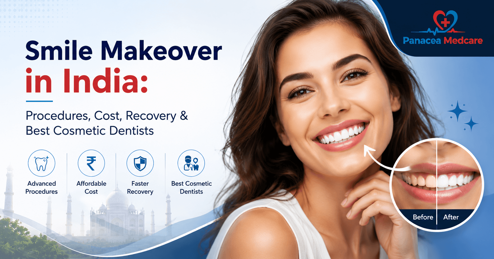Smile Makeover in India: Procedures, Cost, Recovery & Best Cosmetic Dentists